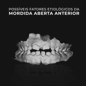 Possíveis fatores etiológicos da mordida aberta anterior