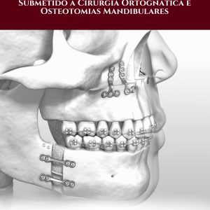 Manejo do paciente submetido a cirurgia ortognática e osteotomias mandibulares