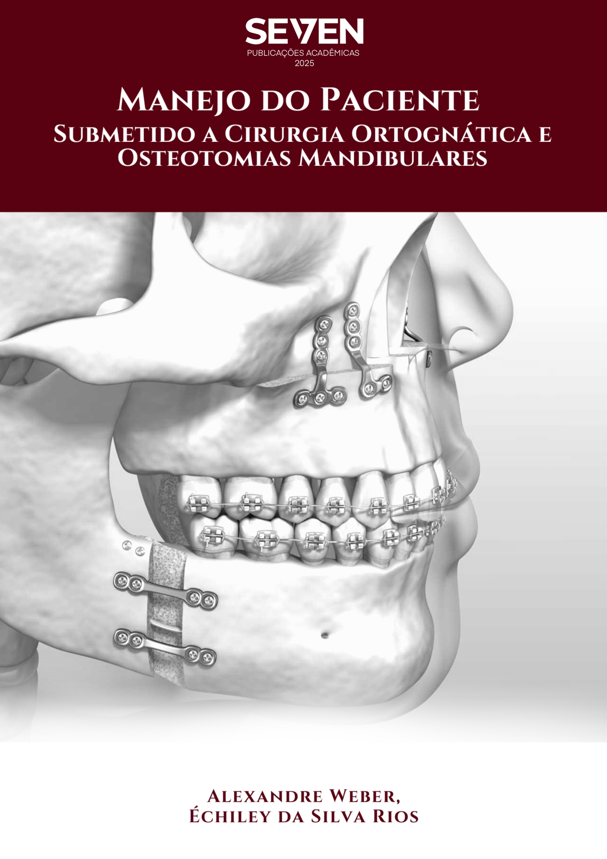 Manejo do paciente submetido a cirurgia ortognática e osteotomias mandibulares