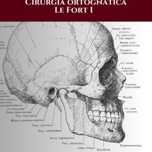 História e Técnica Cirúrgica – Cirurgia ortognática Le Fort I
