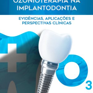Ozonioterapia na Implantodontia – Evidências, Aplicações e Perspectivas Clínicas