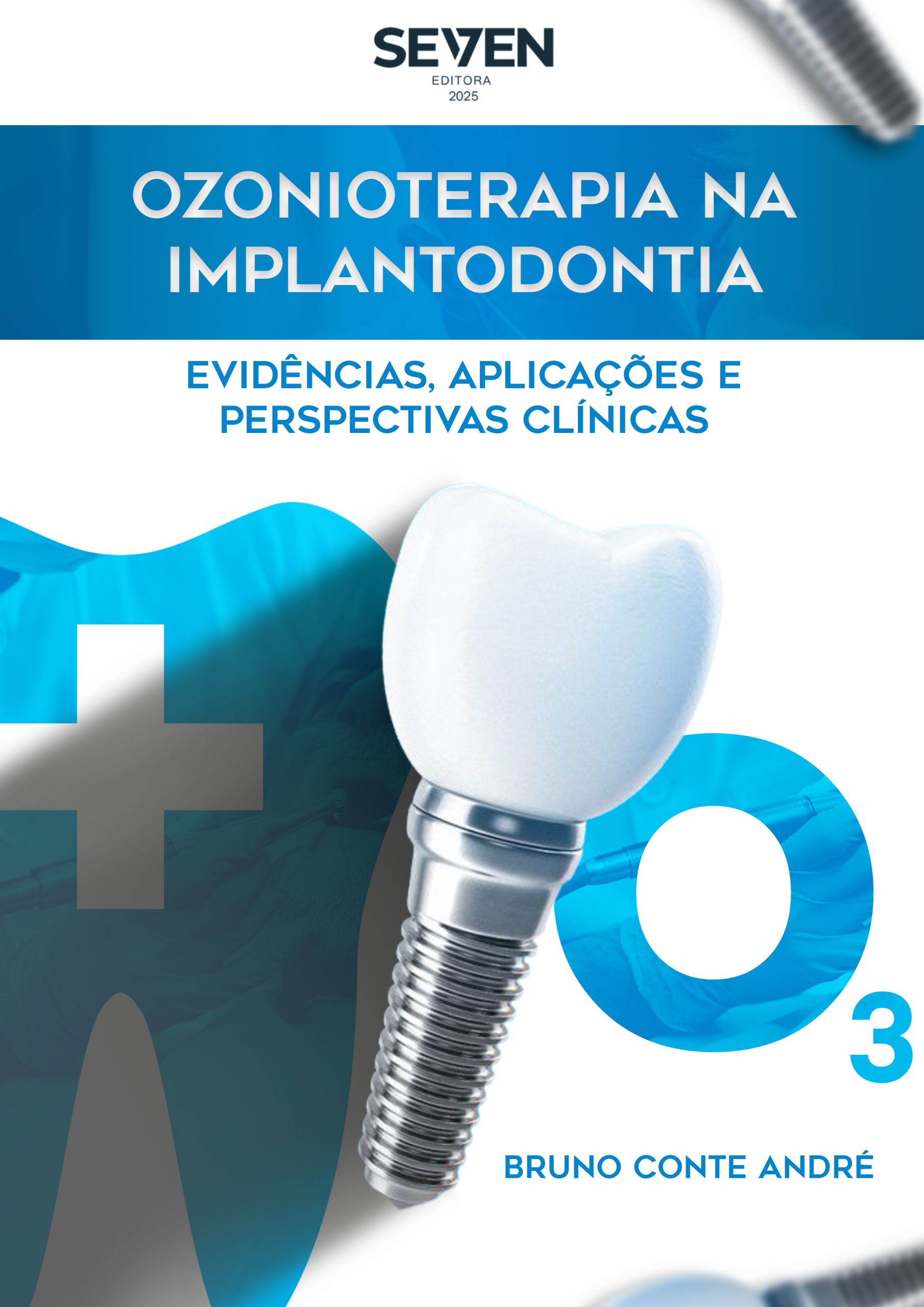 Ozonioterapia na Implantodontia – Evidências, Aplicações e Perspectivas Clínicas