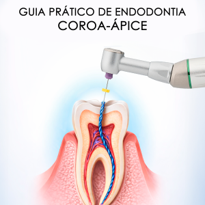 Guia Prático de Endodontia Coroa – Ápice