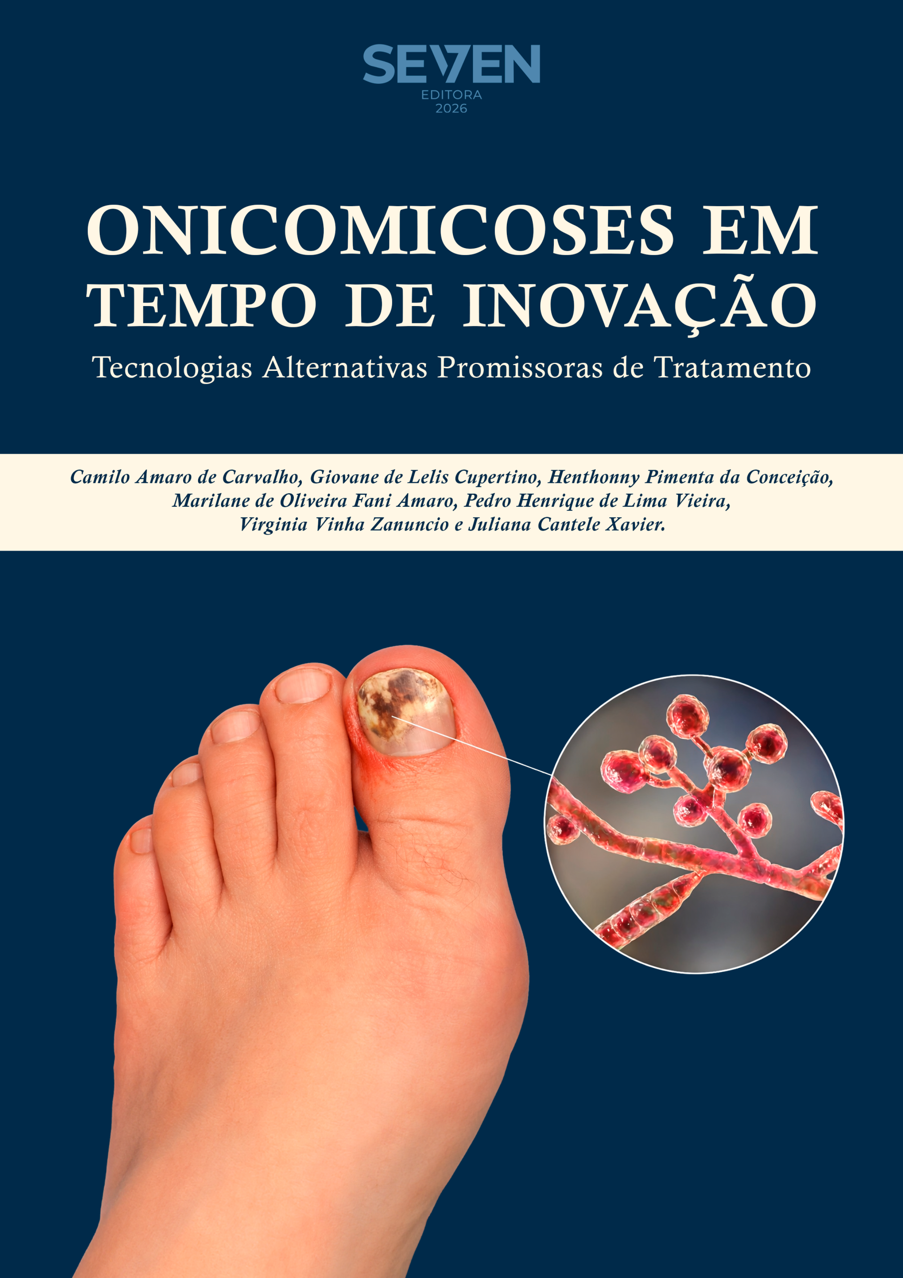 Onicomicoses em Tempo de Inovação: Tecnologias Alternativas Promissoras de Tratamento
